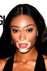 Winnie Harlow profile picture