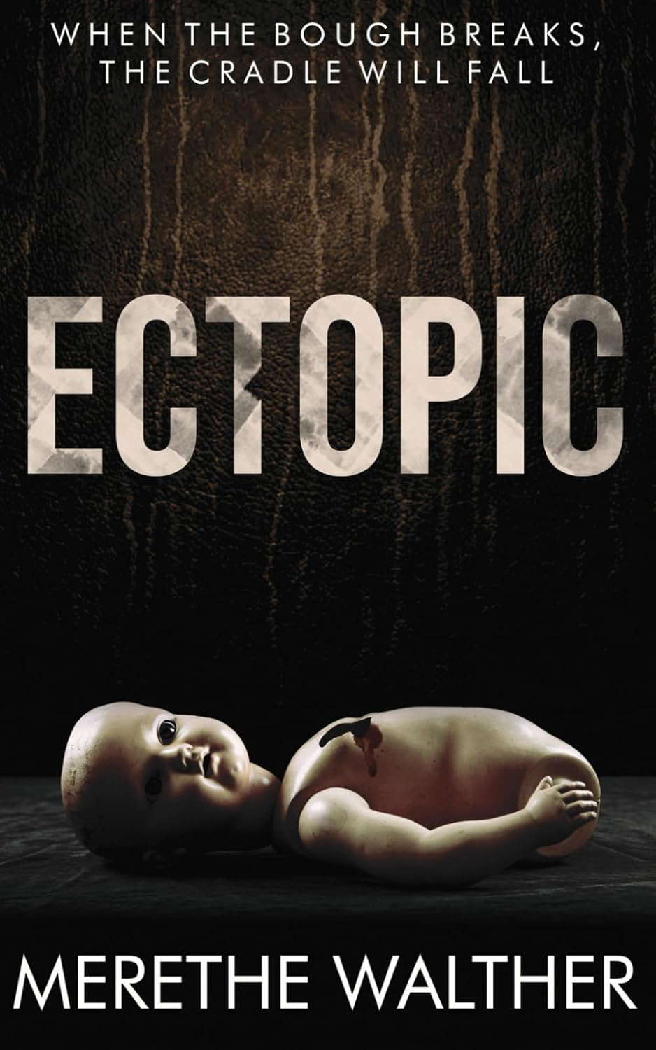 Ectopic poster