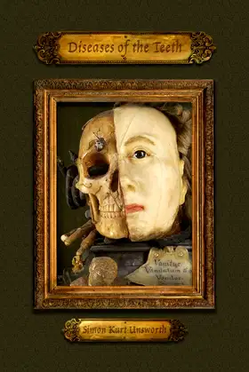 Diseases of the Teeth poster
