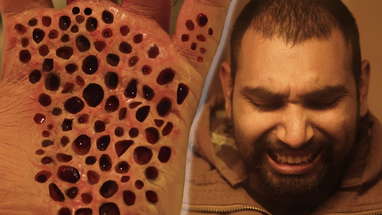 TRYPO VIRUS (TRYPOPHOBIA SHORT HORROR FILM) poster