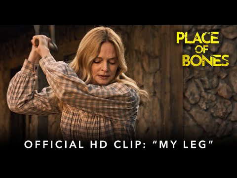 "My Leg"