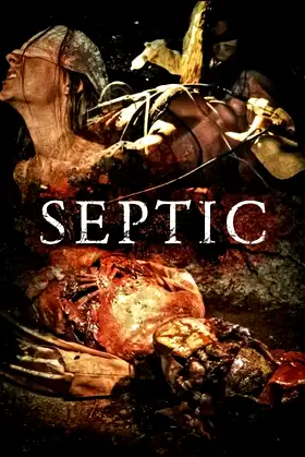 Septic poster