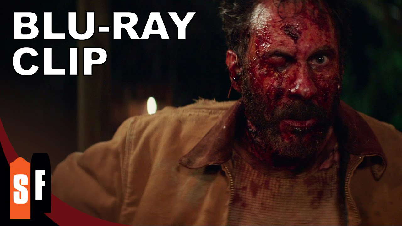 Clip: I'm Burning!