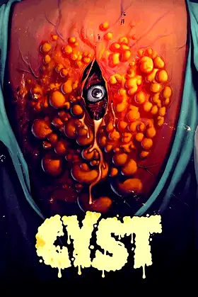 Cyst poster