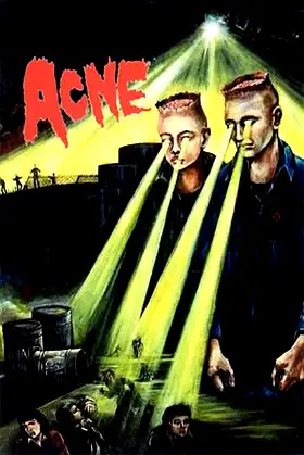 Acne poster