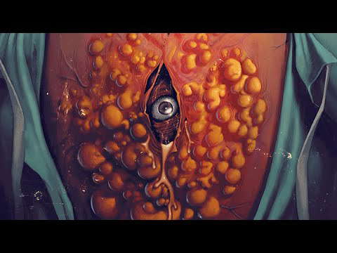 CYST (2022) Official Teaser Trailer (HD) CREATURE FEATURE