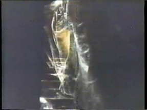 Silent Scream 1980 TV trailer poster
