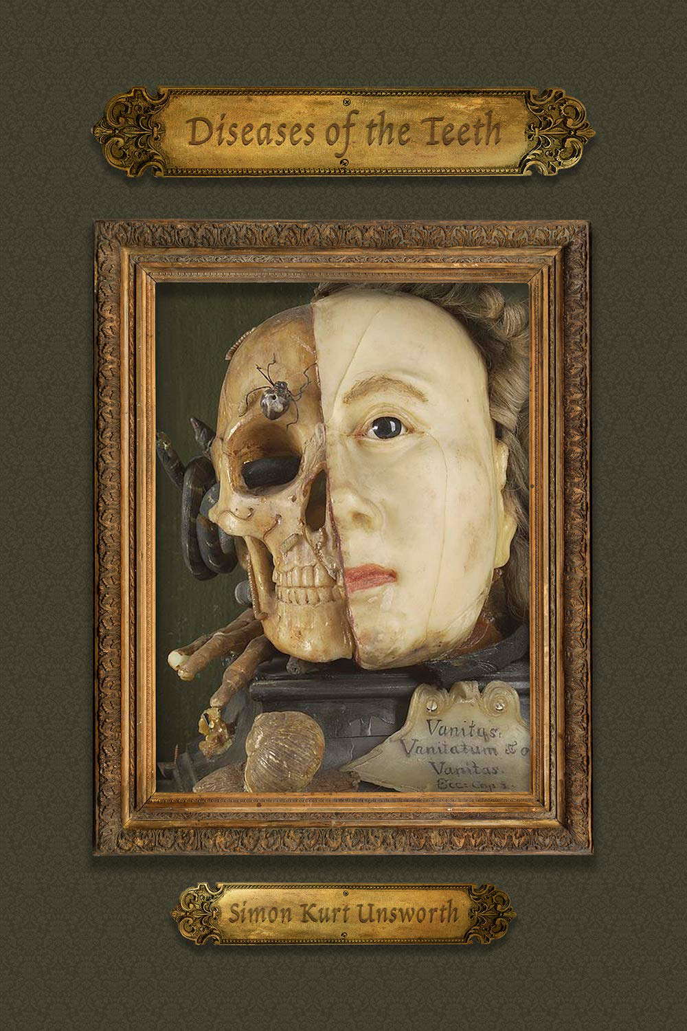 Diseases of the Teeth poster