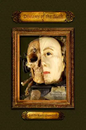 Diseases of the Teeth poster