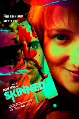Skinned poster