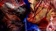 episode poster