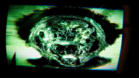 Youchosis screenshot 13